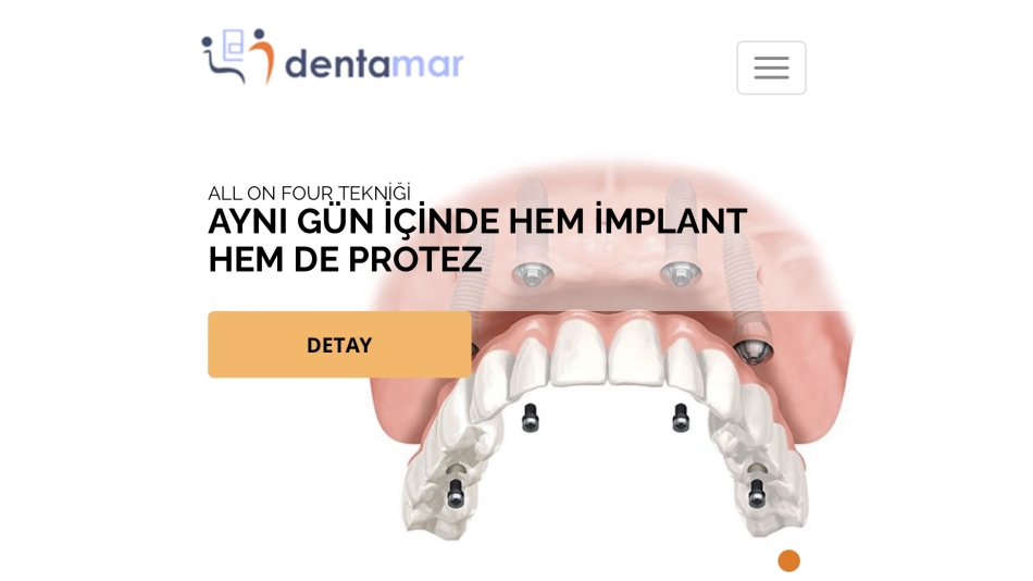 DENTAMARLA ANLAŞMA YAPTIK.